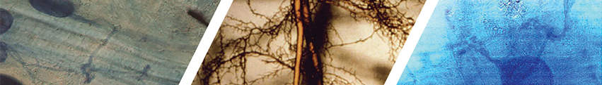 Mycological Mycorrhizae through a microscope